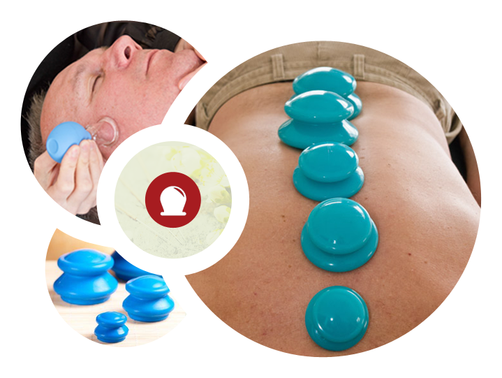 Cupping Therapy